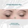 Before and After results of VI Peel Precision Plus Pigment and Aging | Luz MediSpa in Somers, NY