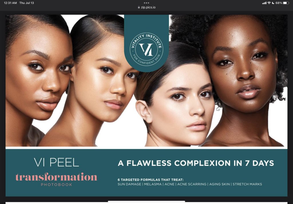 Medical Grade Skin Treats (Peels) | Luz MediSpa in Somers, NY