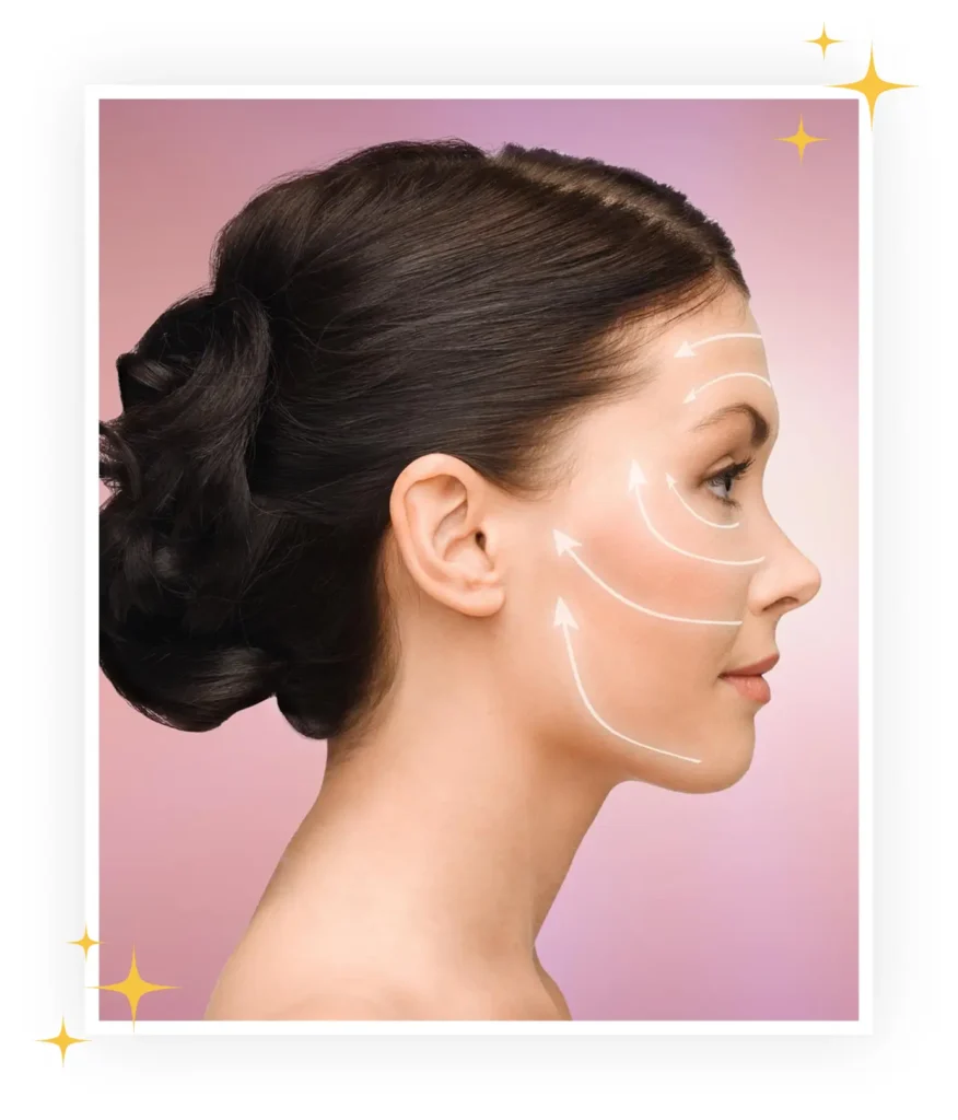 RF microneedling Morpheus8 treatment targeting deeper skin layers in Somers NY