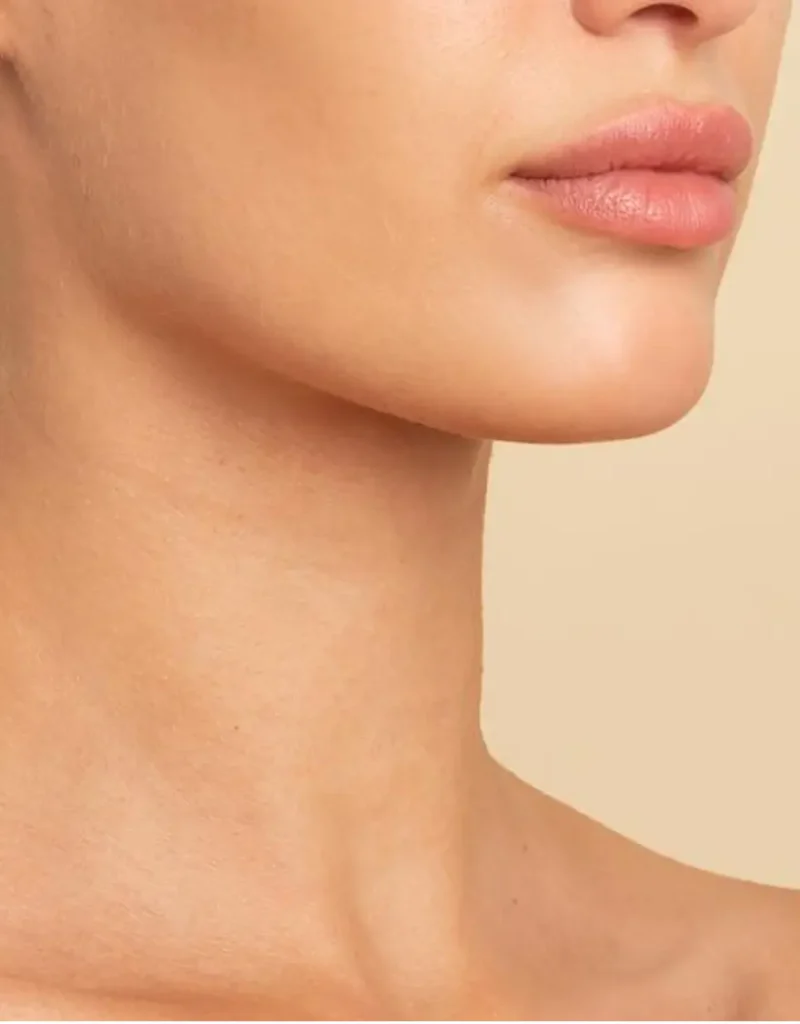 Morpheus8 neck tightening treatment in Somers NY