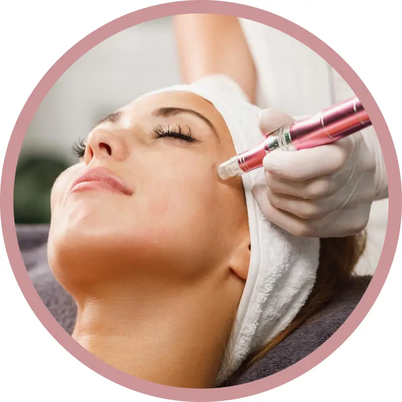 Morpheus8 targeted microneedling treatment creating micro-injuries in Somers NY